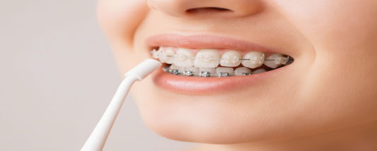 What Is a Water Flosser? Benefits, Types, and How to Use One